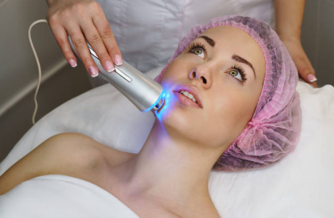 VBeam Laser in Singapore: The Revolutionary Treatment for Flawless Skin